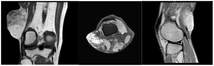https://cdn.ncbi.nlm.nih.gov/pmc/blobs/9cd4/12225420/4bee3e9043c6/reports-07-00058-g001.jpg