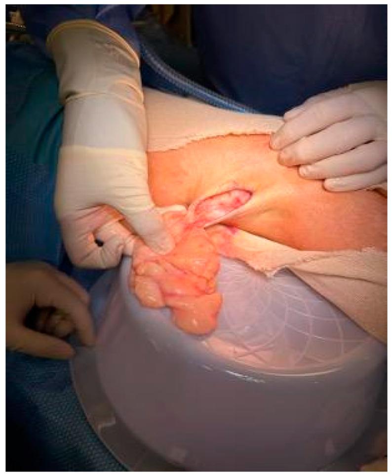 https://cdn.ncbi.nlm.nih.gov/pmc/blobs/9cd4/12225420/df877ec15cb3/reports-07-00058-g002.jpg