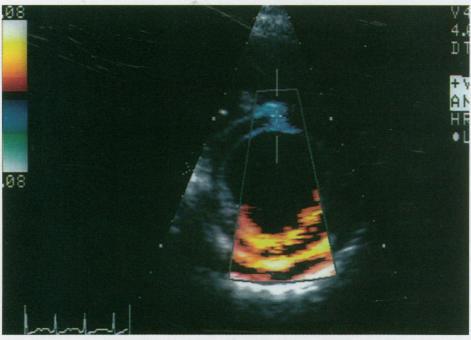 https://cdn.ncbi.nlm.nih.gov/pmc/blobs/9cdd/325469/d47e13cd255e/thij00027-0049-a.jpg