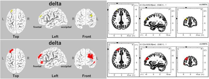 https://cdn.ncbi.nlm.nih.gov/pmc/blobs/9ce3/11732644/630ed42f251c/painreports-10-e1233-g004.jpg