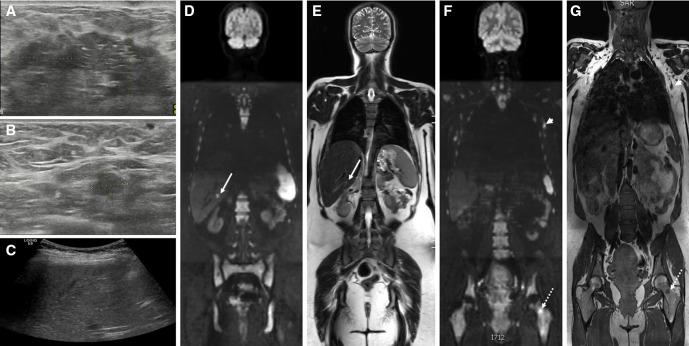 https://cdn.ncbi.nlm.nih.gov/pmc/blobs/9ce9/7925814/ea40ae9cab9f/ijgc-2020-001779f02.jpg