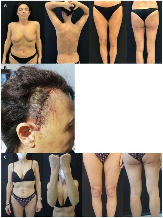 https://cdn.ncbi.nlm.nih.gov/pmc/blobs/9ced/11135952/6e9c7bb680e5/dp1402a152g003.jpg