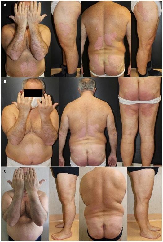 https://cdn.ncbi.nlm.nih.gov/pmc/blobs/9ced/11135952/9b32f4f9b9f6/dp1402a152g002.jpg