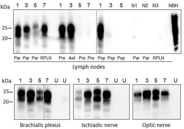 https://cdn.ncbi.nlm.nih.gov/pmc/blobs/9cf1/11845164/fcabeea8e8a1/24-0903-F2.jpg