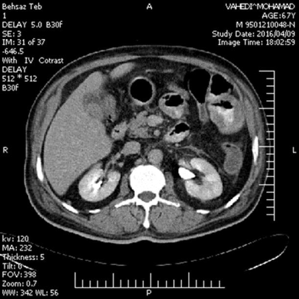 https://cdn.ncbi.nlm.nih.gov/pmc/blobs/9cf3/6121338/c3af87bc253b/cjim-9-312-g003.jpg