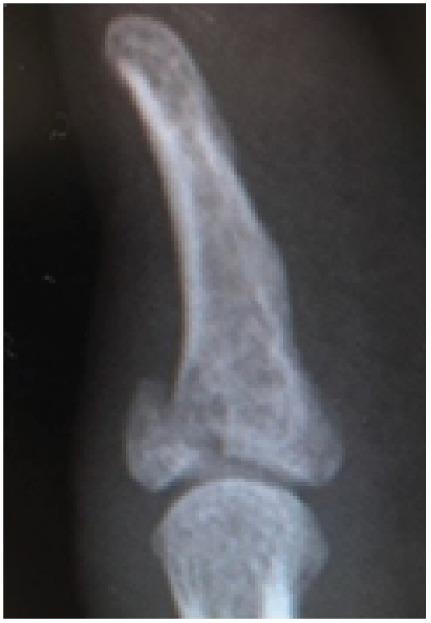 https://cdn.ncbi.nlm.nih.gov/pmc/blobs/9cf6/6875408/787fee188fa5/CRIOR2019-3538405.001.jpg