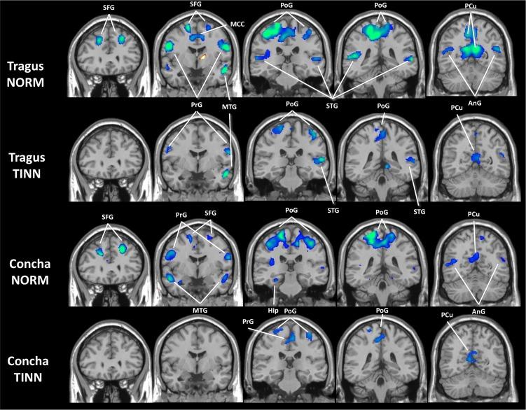 https://cdn.ncbi.nlm.nih.gov/pmc/blobs/9cfe/6261575/2947641660dd/pone.0207281.g004.jpg