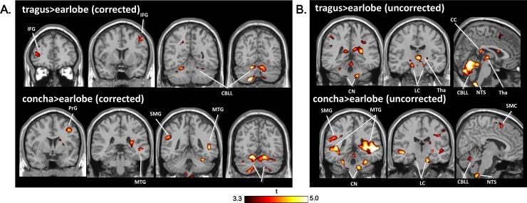 https://cdn.ncbi.nlm.nih.gov/pmc/blobs/9cfe/6261575/c503dce30855/pone.0207281.g002.jpg