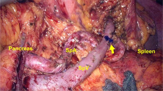 https://cdn.ncbi.nlm.nih.gov/pmc/blobs/9d01/10794680/8651167bc7a3/40792_2024_1808_Fig4_HTML.jpg