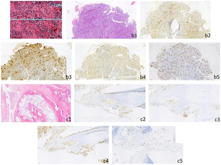 https://cdn.ncbi.nlm.nih.gov/pmc/blobs/9d02/9909182/316b08f78adc/fneur-14-1037673-g0004.jpg