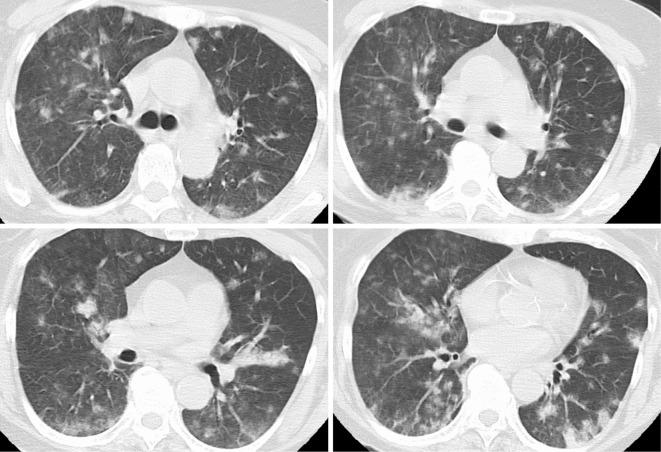 https://cdn.ncbi.nlm.nih.gov/pmc/blobs/9d0a/9593163/c7249357cdfc/1349-7235-61-2961-g001.jpg