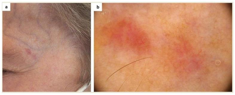 https://cdn.ncbi.nlm.nih.gov/pmc/blobs/9d12/10298540/0df58338ae9a/ijms-24-09840-g004.jpg