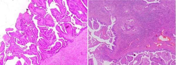 https://cdn.ncbi.nlm.nih.gov/pmc/blobs/9d12/3247868/8f3db4298a6a/1752-1947-5-556-2.jpg