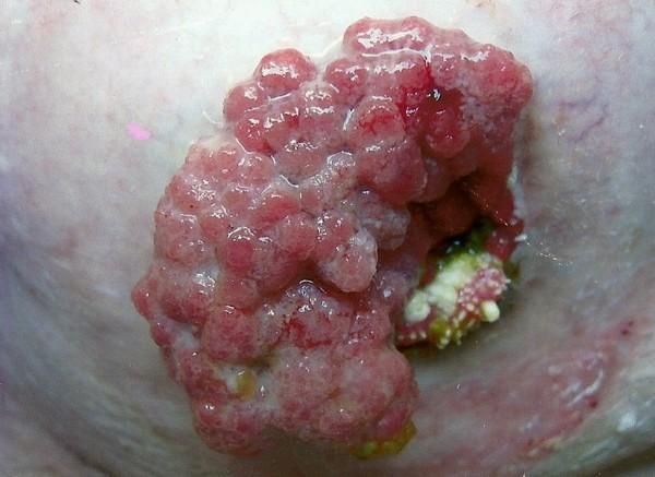 https://cdn.ncbi.nlm.nih.gov/pmc/blobs/9d12/3247868/a86dd243bcb6/1752-1947-5-556-3.jpg