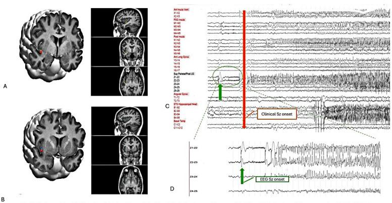 https://cdn.ncbi.nlm.nih.gov/pmc/blobs/9d13/11897517/6a7d1a754875/fsurg-12-1535408-g003.jpg