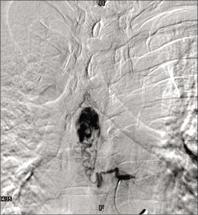 https://cdn.ncbi.nlm.nih.gov/pmc/blobs/9d17/7881500/8da76722a52f/SNI-12-24-g006.jpg