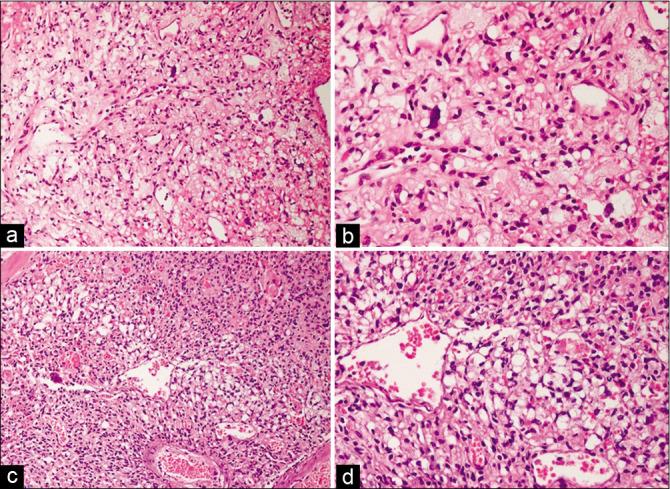 https://cdn.ncbi.nlm.nih.gov/pmc/blobs/9d17/7881500/a6becc2fb26f/SNI-12-24-g001.jpg