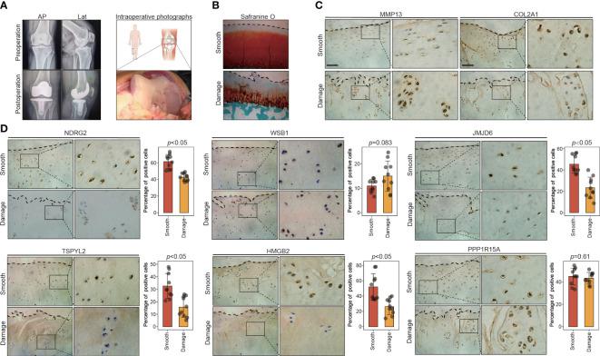 https://cdn.ncbi.nlm.nih.gov/pmc/blobs/9d19/10077735/7590627a5666/fimmu-14-1077003-g005.jpg