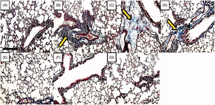 https://cdn.ncbi.nlm.nih.gov/pmc/blobs/9d19/7006747/d322edcefcad/IPHB_A_1710218_F0007_C.jpg