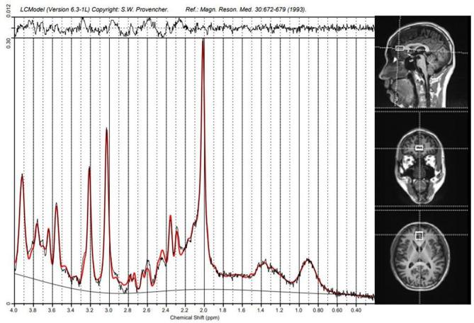 https://cdn.ncbi.nlm.nih.gov/pmc/blobs/9d19/7644538/8c89fbdcb66e/fpsyt-11-553269-g0003.jpg