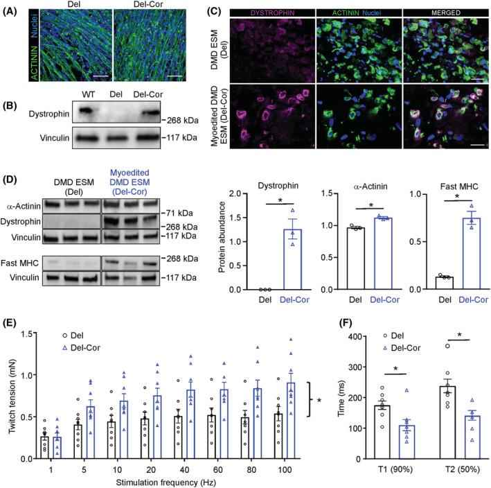 https://cdn.ncbi.nlm.nih.gov/pmc/blobs/9d19/9745484/90152d3bf9dc/JCSM-13-3106-g008.jpg