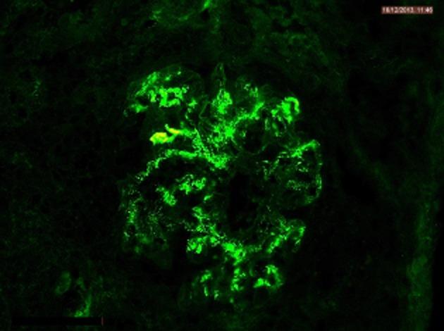 https://cdn.ncbi.nlm.nih.gov/pmc/blobs/9d26/4263495/6d1ab1bfa75c/rcr20002-0138-f2.jpg