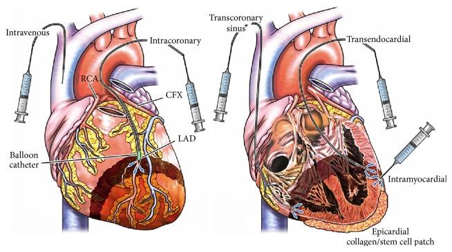 https://cdn.ncbi.nlm.nih.gov/pmc/blobs/9d27/4736428/c9e355c955e1/SCI2016-9240652.003.jpg