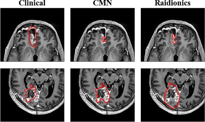 https://cdn.ncbi.nlm.nih.gov/pmc/blobs/9d2e/12357038/6228a2325fe0/gr4.jpg