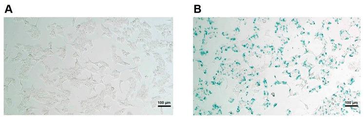 https://cdn.ncbi.nlm.nih.gov/pmc/blobs/9d2e/7998640/412406672676/polymers-13-00885-g001.jpg
