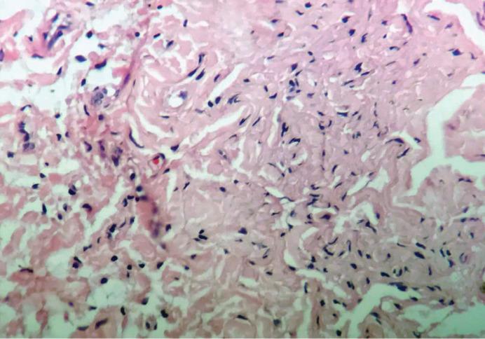 https://cdn.ncbi.nlm.nih.gov/pmc/blobs/9d34/8570624/5b382ce9b998/ijcn-15-109-g003.jpg