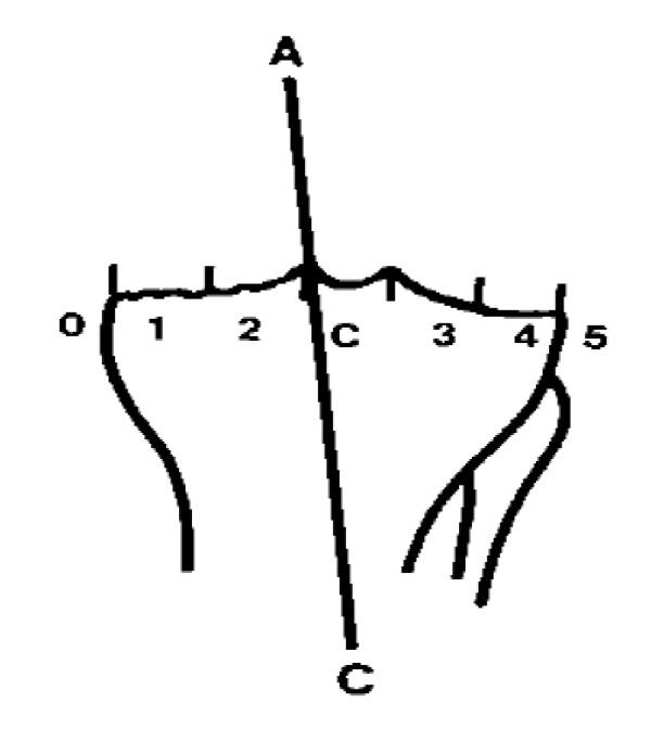 https://cdn.ncbi.nlm.nih.gov/pmc/blobs/9d39/3019141/ab937fb9fb3c/1749-799X-5-94-1.jpg