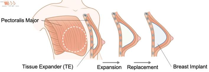 https://cdn.ncbi.nlm.nih.gov/pmc/blobs/9d3a/11650608/09449bd8a493/wjon-15-853-g002.jpg