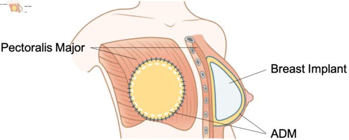 https://cdn.ncbi.nlm.nih.gov/pmc/blobs/9d3a/11650608/46b6244cad0d/wjon-15-853-g004.jpg