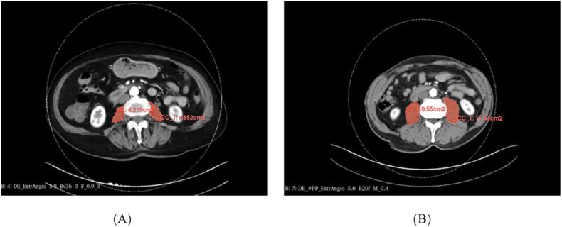 https://cdn.ncbi.nlm.nih.gov/pmc/blobs/9d3b/10999995/4d69ece0672d/gr1.jpg