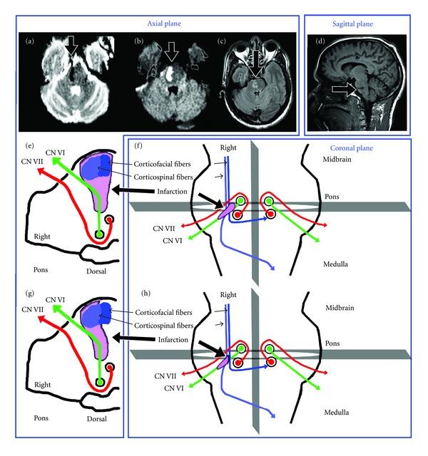 https://cdn.ncbi.nlm.nih.gov/pmc/blobs/9d4f/3423663/91d2dce60b3f/CRIM.NM2012-583123.001.jpg