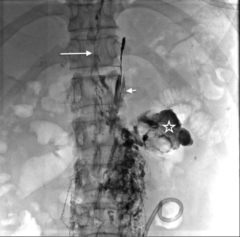 https://cdn.ncbi.nlm.nih.gov/pmc/blobs/9d50/9849999/d3bc91937d4e/gr2.jpg