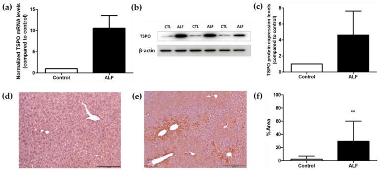 https://cdn.ncbi.nlm.nih.gov/pmc/blobs/9d53/11173123/09dfe8a3b034/ijms-25-05942-g006.jpg
