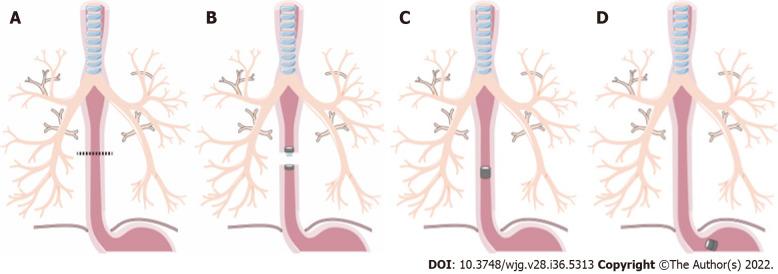 https://cdn.ncbi.nlm.nih.gov/pmc/blobs/9d53/9521523/546ea8cac1d8/WJG-28-5313-g001.jpg