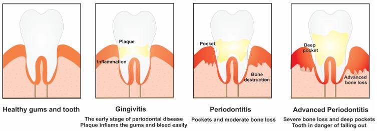 https://cdn.ncbi.nlm.nih.gov/pmc/blobs/9d5e/9572898/18b7a46df5fc/jcm-11-05854-g003.jpg