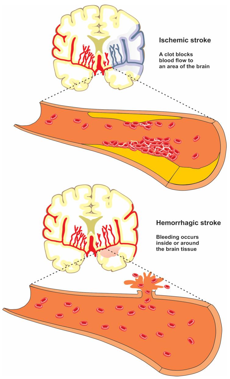 https://cdn.ncbi.nlm.nih.gov/pmc/blobs/9d5e/9572898/c26771dbedc0/jcm-11-05854-g002.jpg