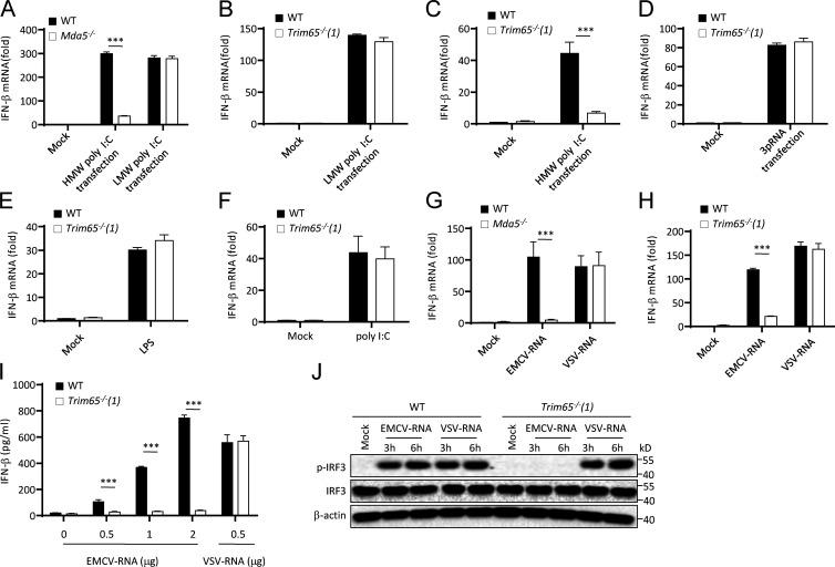 https://cdn.ncbi.nlm.nih.gov/pmc/blobs/9d60/5294850/e32efd4e9dd8/JEM_20160592_Fig4.jpg