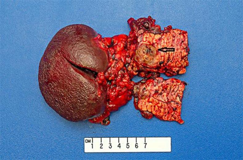 https://cdn.ncbi.nlm.nih.gov/pmc/blobs/9d61/4560303/5be3ed1cc01b/crg-0009-0266-g04.jpg