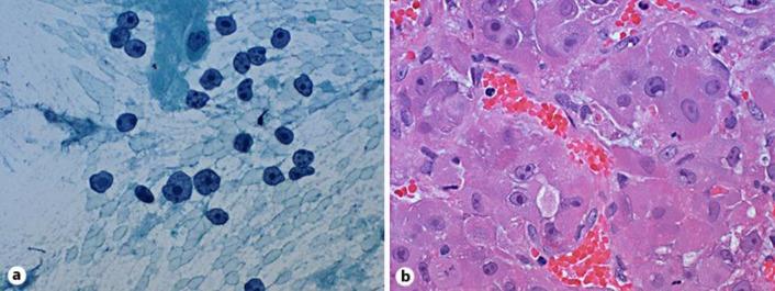 https://cdn.ncbi.nlm.nih.gov/pmc/blobs/9d61/4560303/c397cc3955d5/crg-0009-0266-g03.jpg