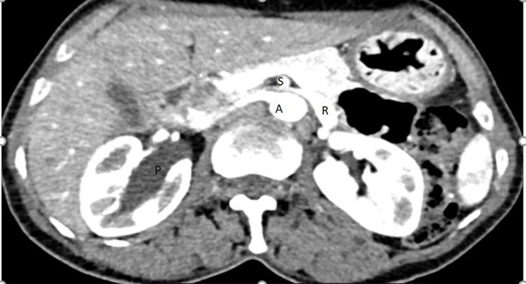 https://cdn.ncbi.nlm.nih.gov/pmc/blobs/9d64/11178079/a1f928929e47/RRU-16-131-g0001.jpg