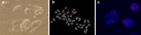 https://cdn.ncbi.nlm.nih.gov/pmc/blobs/9d6d/3002156/391aafaa65c6/335_2010_9300_Fig1_HTML.jpg