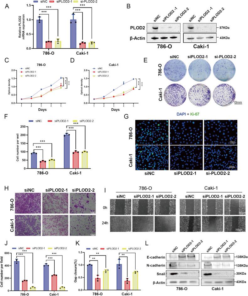 https://cdn.ncbi.nlm.nih.gov/pmc/blobs/9d75/10679098/96429f745e13/41419_2023_6298_Fig4_HTML.jpg