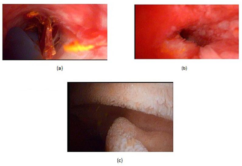 https://cdn.ncbi.nlm.nih.gov/pmc/blobs/9d7c/6556483/1ec8ec0f60f7/gr6.jpg