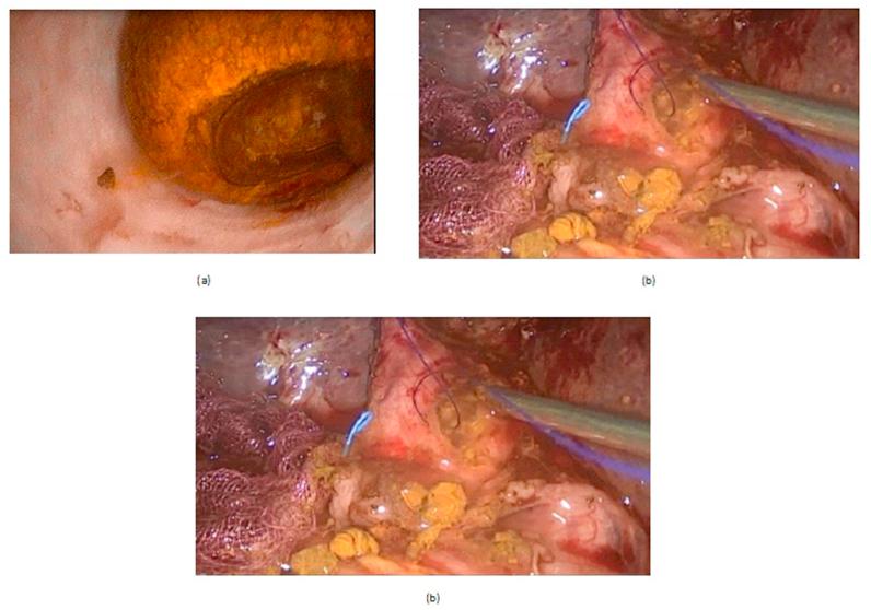 https://cdn.ncbi.nlm.nih.gov/pmc/blobs/9d7c/6556483/47328c2348c1/gr1.jpg