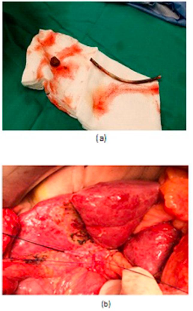 https://cdn.ncbi.nlm.nih.gov/pmc/blobs/9d7c/6556483/c673bd5d7b39/gr3.jpg