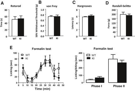 https://cdn.ncbi.nlm.nih.gov/pmc/blobs/9d7d/5793798/3b193afa9e67/EMBJ-37-427-g006.jpg
